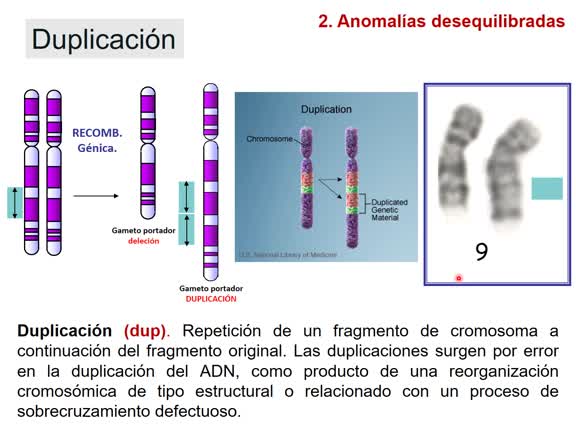 Tema 21 Anomalías estructurales